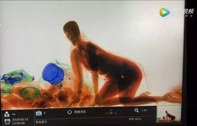 X光機(jī) X光機(jī)